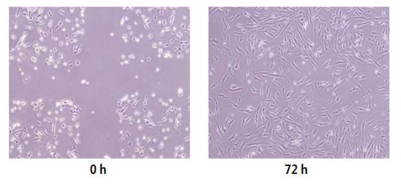 상처자극에 의한 줄기세포배양액의 cell morphology