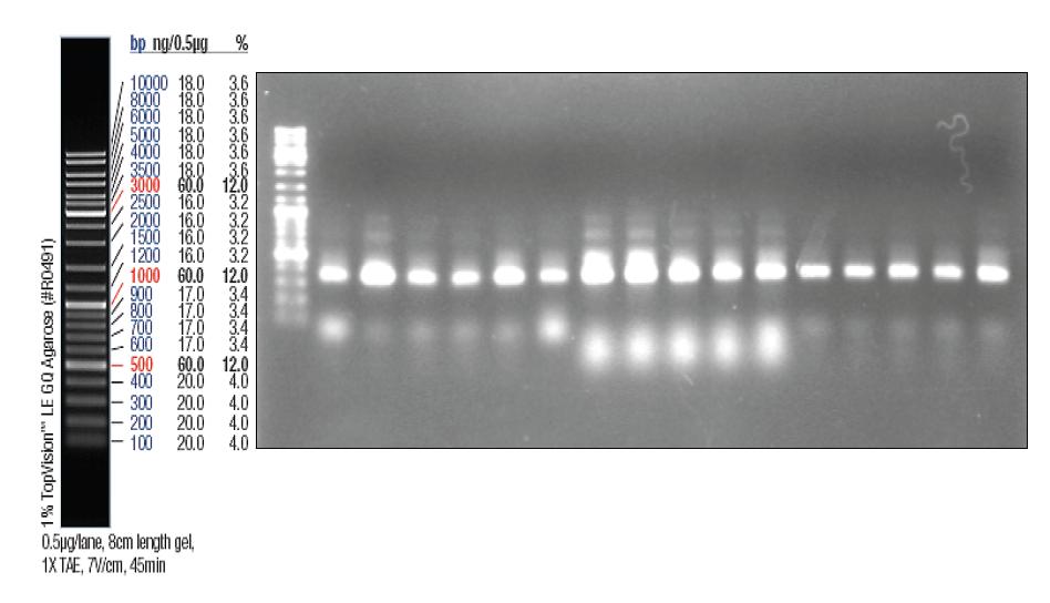 PCR amplification for 16S rRNA gene of intestinal microbiota.