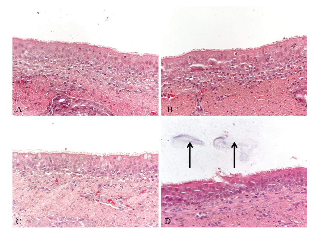 Trachea, pig exposed experimentally with artificial yellow sand.