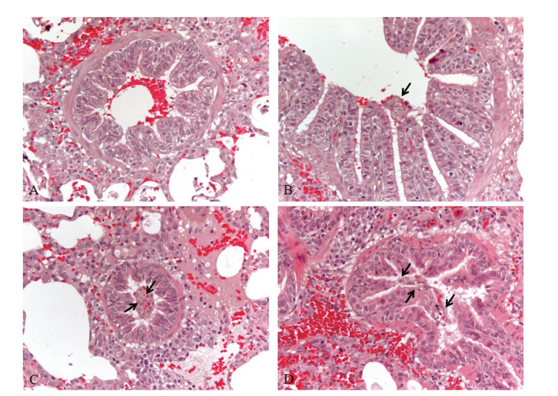 Bronchiole, pig exposed experimentally with artificial yellow sand.