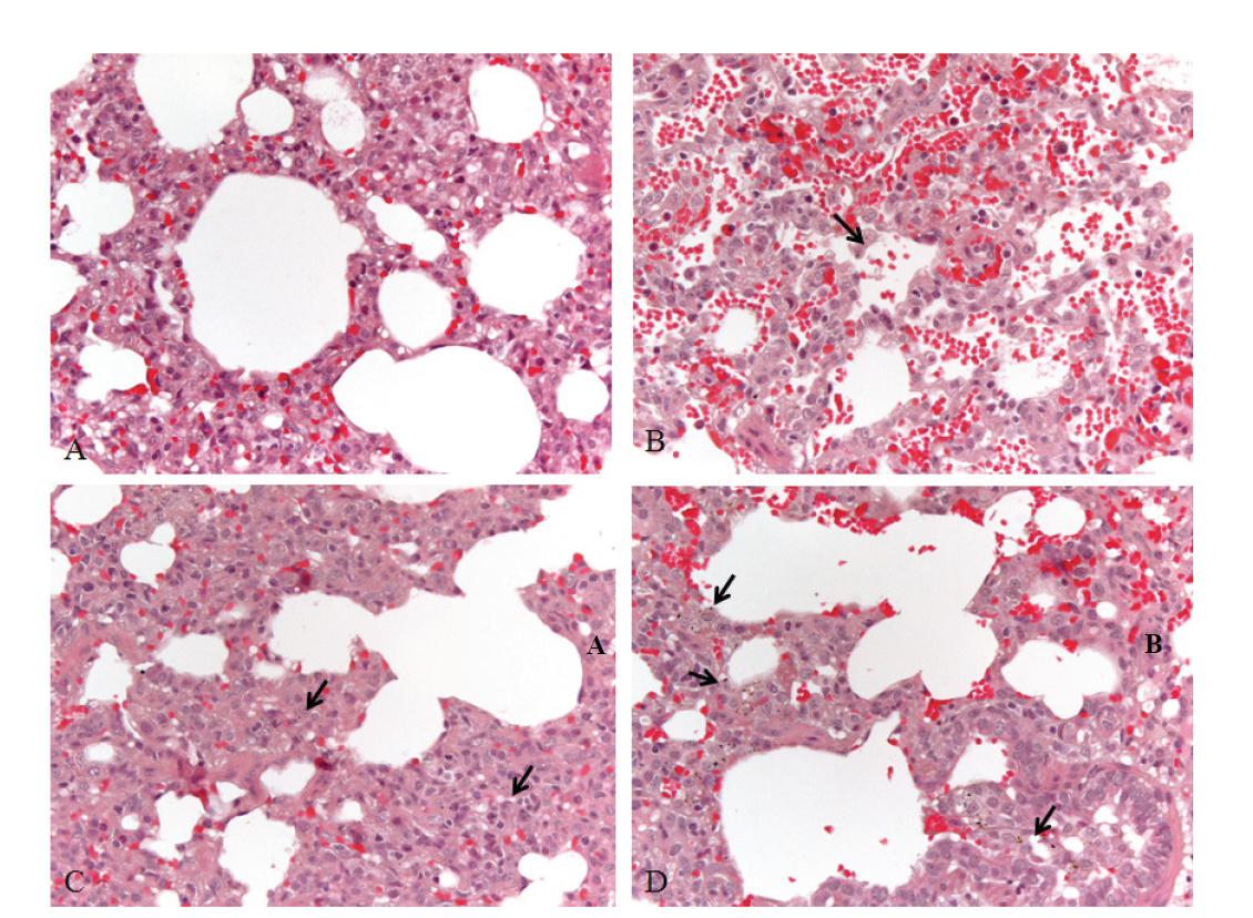 Alveoli, pig exposed experimentally with artificial yellow sand.