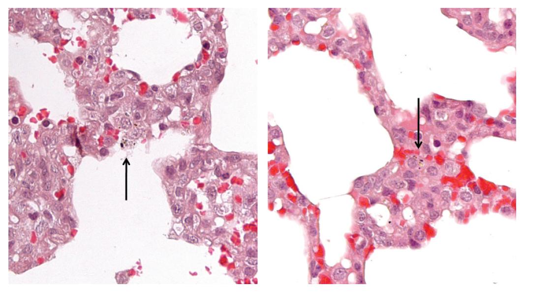 Alveoli, pig exposed experimentally with artificial yellow sand.