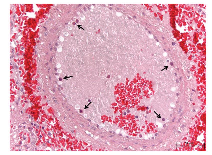 Lung, pig exposed experimentally with artificial yellow sand.