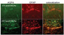 Aquaprorin 4와 GFAP(astrocyte marker)의 colocalization.