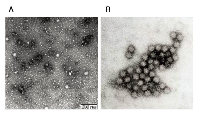 적채시료(A, PTA염색)와 노로바이러스(B, 대조구)의 전자현미경 사진 비교.