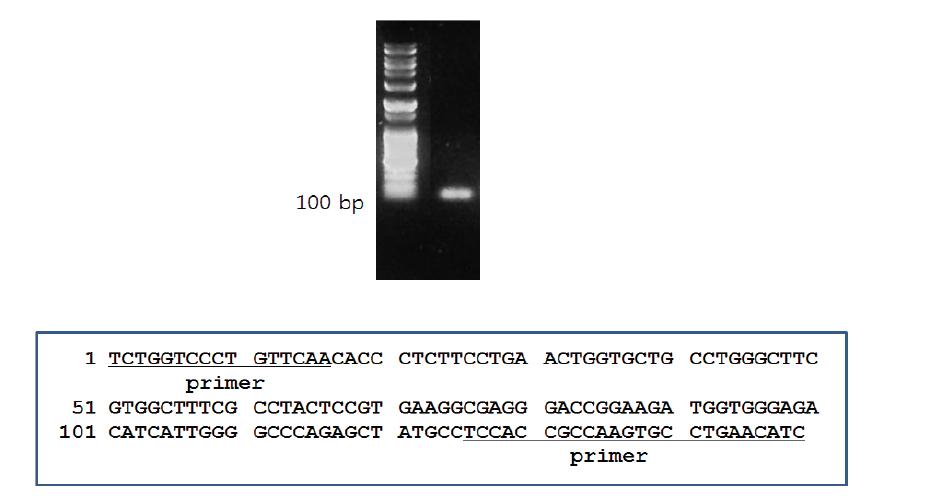 범용 primer를 이용하여 확보한 돼지 IFITM-1 유전자 부분.