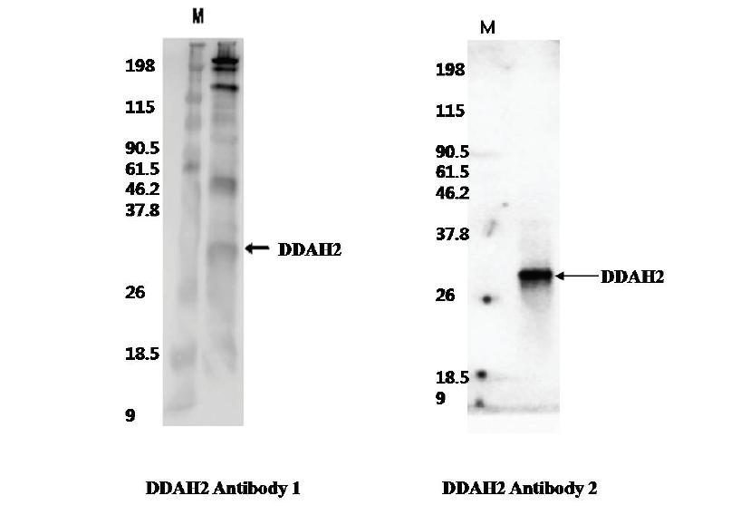 Western을 이용한 DDAH2 항체의 효율 검정.