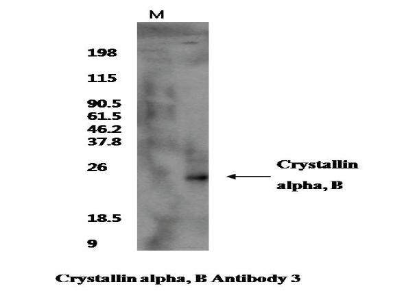 Western을 이용한 Crystallin ahpha B 항체의 효율 검정.