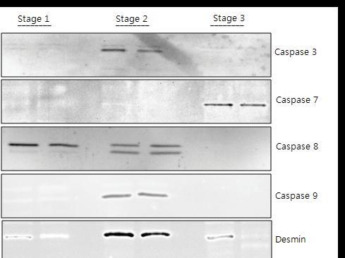 Changes in caspases, 3, 7, 8, 9 and desmins during propagation (stage 1), differentiation (Stage 2) and hypoxic condition (Stage 3).