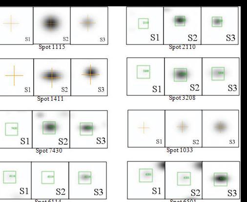 Representation 2D electrophoresis profile and spots numbers for muscle satellite cells at stage 1, stage 2 and stage 3.