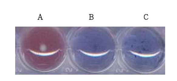 색깔 변화를 이용한 항균 펩타이드 생성 프로바이오틱 균주 선별.