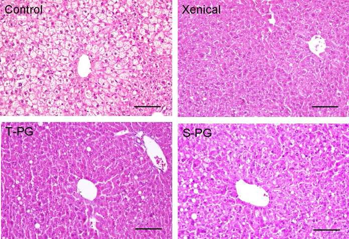 Fatty liver inhibition effect of in Platycodon grandiforum-derived total extract and saponin administration daily for 12 weeks in HFD-fed C57BL/6 mice.