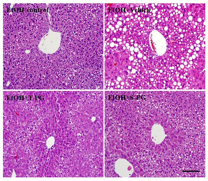 Fatty liver inhibition effect of Platycodon grandiforum-derived total extract and saponin administration daily for 6 weeks in EtOH-treated C57BL/6 mice.