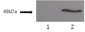 xylose isomerase 유전자 주정 효모에서 성공적으로 발현하여 Xylose 를 유일한 탄소원으로 성장하는 효모균주 시스템 개발