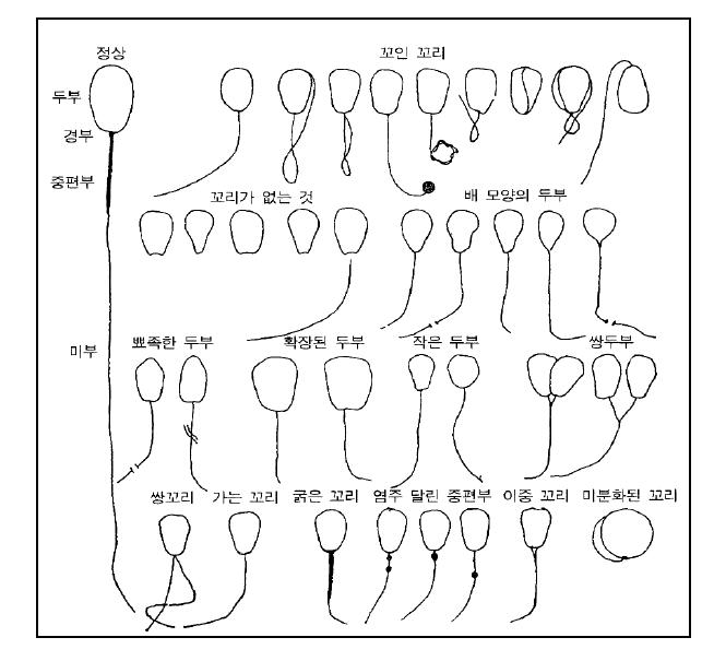 기형 정자의 분류
