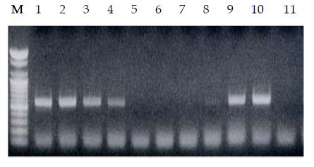 Diagnosis of viruliferous insect for RSV by the mixed heads of SBPH having 30% viruliferous insect rate.