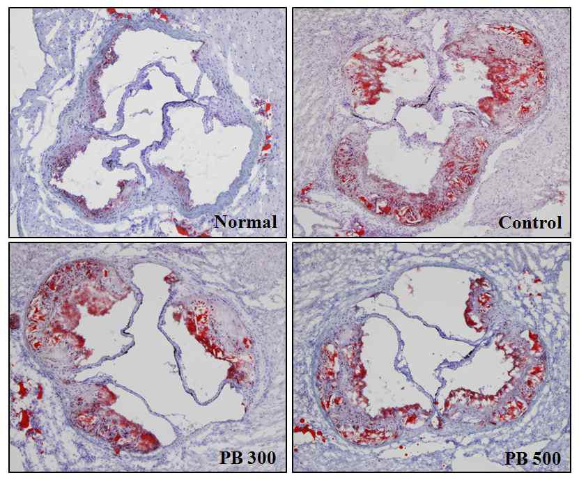 장수상황버섯 항산화 폴리페놀 추출물의 투여에 따른 apoE-/- 마우스의 대동맥동 (aortic sinus) 내 지방함량.