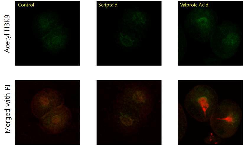 Scriptaid와 Valproic acid가 돼지 복제란의 histone H4 acetylation에 미치는 영향