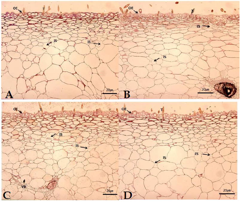 Microscopic comparison of the fruit skin at harvest season among 4 peach cultivars