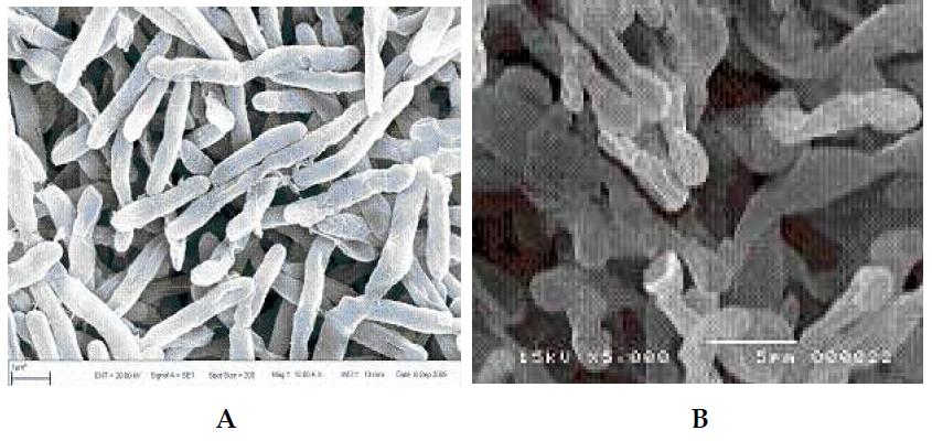 DF-100 처리 전 후의 E.coli 의 전자 현미경 사진(A: 처리 전, B: 처리 후)