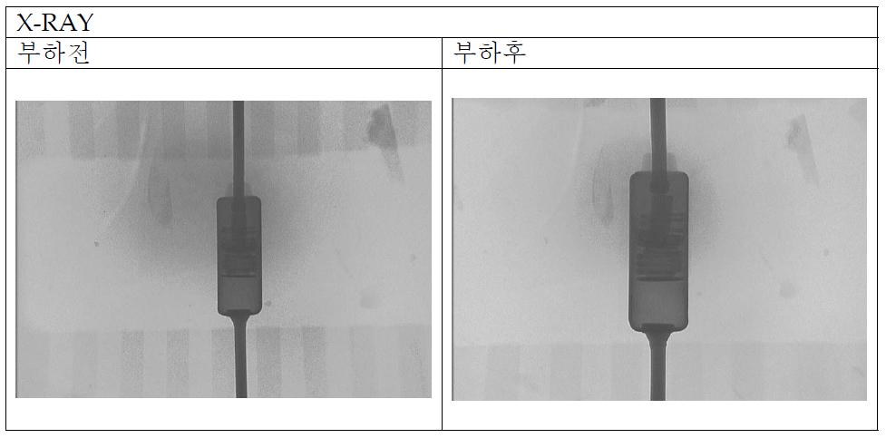 부하전/후에 따른 X-RAY