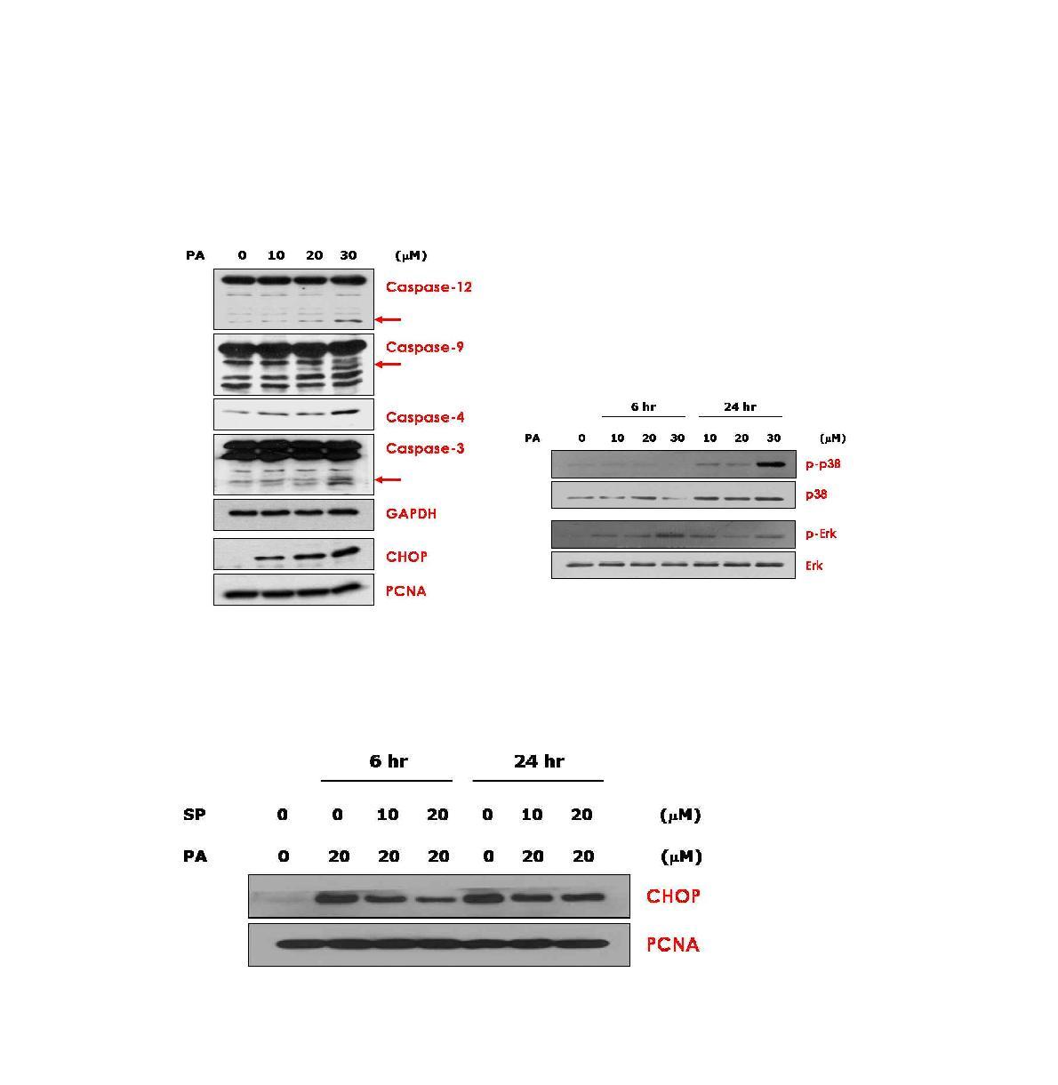 Pimaradienoic acid의 caspase 및 세포사멸 조절 단백질 발현, 인산화에 미치는 영향