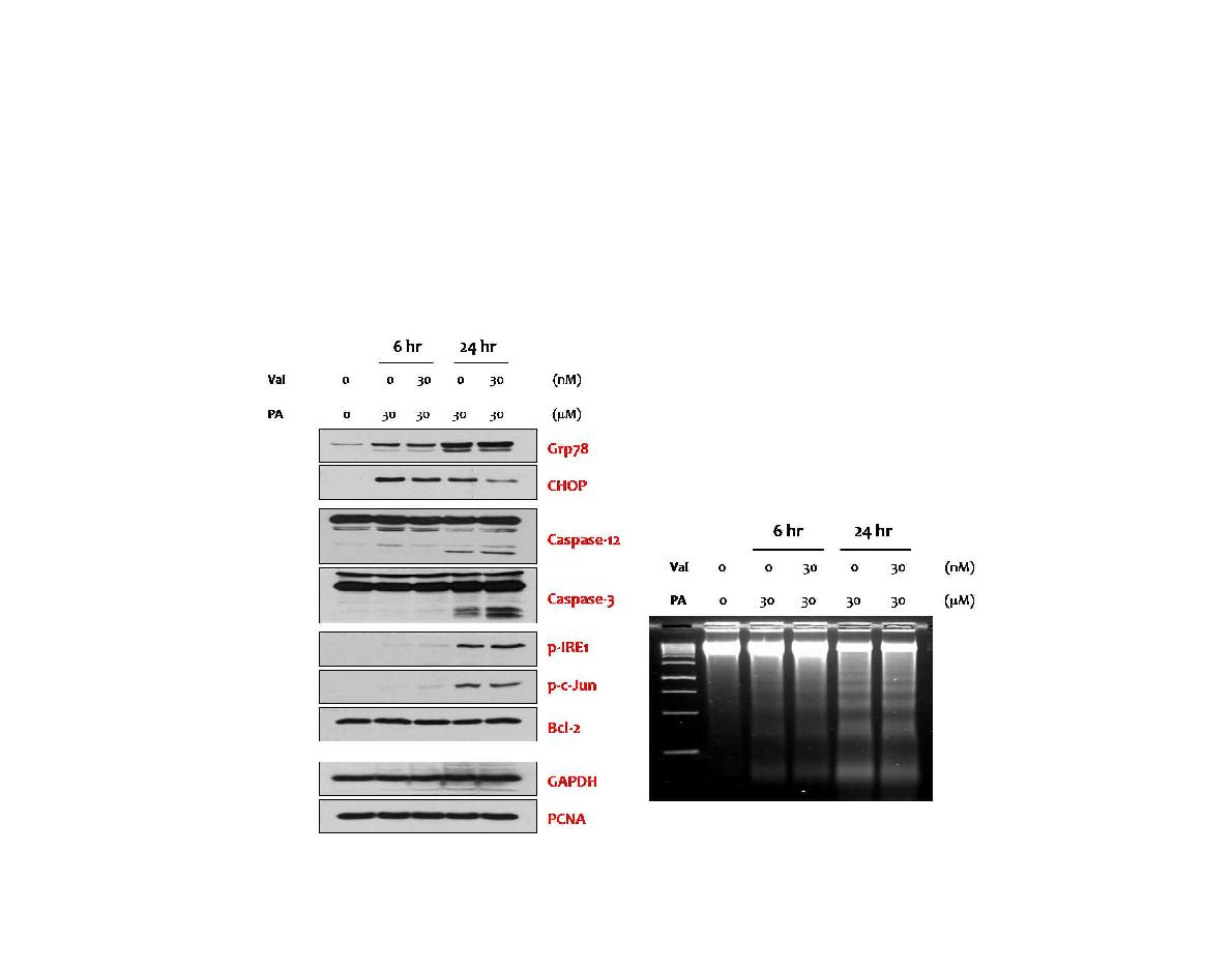 Valinomycin의 ER-stress와 세포사멸에 미치는 영향