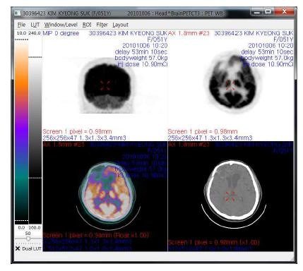 PET, CT 및 MR 등의 3차원 의료영상 가시화 결과