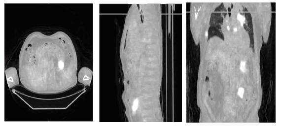 Fused images of bone extract CT and PET