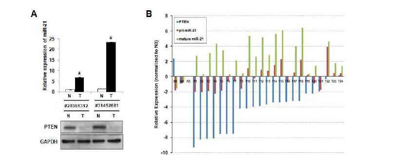 악성뇌신경교종환자의 정상조직과 암조직에서의 PTEN의 발현의 조사 (A) 마이크로RNA processing 과정의 전구체와 최종산물인 성숙 마이크로RNA의 발현변화에 대한 정량적인 RT-PCR 결과 (B).