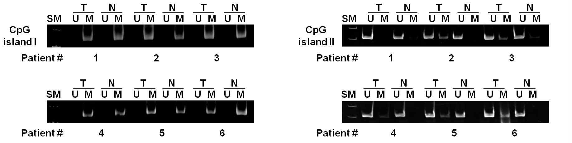 간암조직에서의 catalase promoter의 methylation 상태 분석