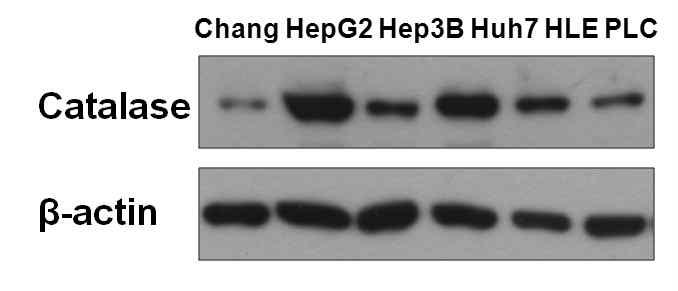 간암 세포주에서 catalase protein 발현의 분석