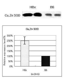 HBx transgenic mouse 와 B6 mouse의 Cu, Zn SOD의 발현차이 확인.