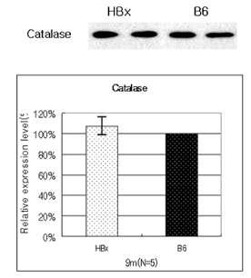 HBx transgenic mouse와 B6 mouse의 catalase의 발현차이 확 인.