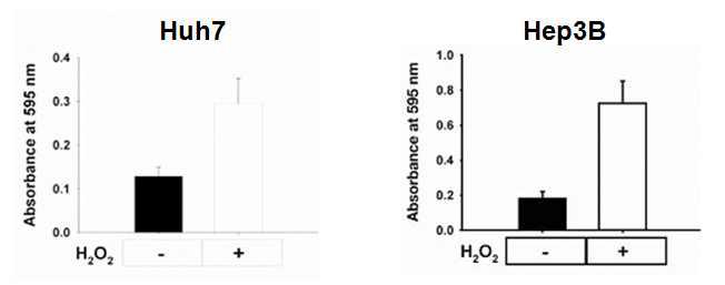 간암 세포주에 H2O2를 4일간 treatment한 후, invasion assay를 수행함.