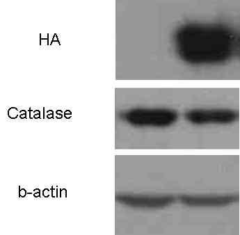 Snail에 의해 catalase의 발현이 감소하 는 것을 immunoblot으로 확인하였음.