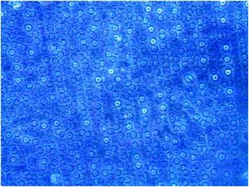 그림 3-10. 현미경으로 관찰한 yeast 사진