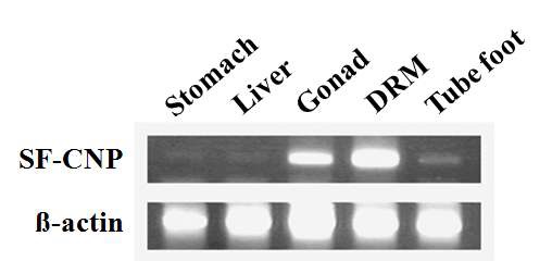 Fig. 46. SF-CNP tissue type expression: lane 1, stomach; lane 2, liver; lane 3, gonad; lane 4, dorsal retractor muscle (DRM); lane 5, tube foot. Expression of a gene encoding the β-actin was used as a control.