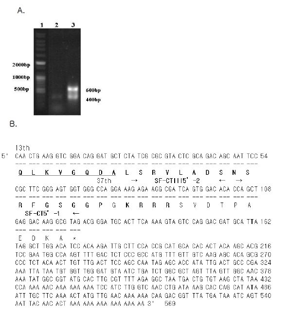 Fig. 36. 3’ RACE PCR products from Asterina pectinifera cDNA (A) and sequencing result (B): (A) Lane 1: Bioneer 100bp plus DNA ladder, Lane 2: SF-CT-1 primer -related PCR products from Asterina pectinifera cDNA, Lane 3: SF-CT-2 primerrelated PCR products from Asterina pectinifera cDNA. (B) The sequencing result was 569bp including 446bp as a 3’UTR. SF-CT 5’primers were underlined.