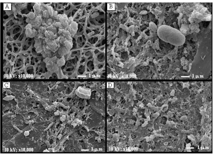 그림 3-39. 초음파 처리한 슬러지 SEM(Scanning electron micrographs)사진