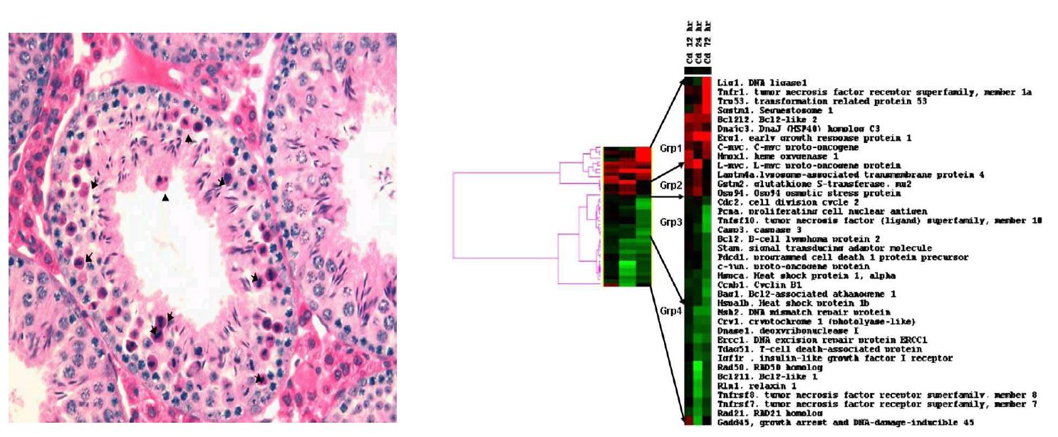 그림 3. 카드뮴에 의해 유도된 testicular hemorrhagic necrosis (왼쪽)와 카드뮴으로 유도된 독성 및 발암성과 관련된 유전자 분류를 위한 clustering (오른쪽)
