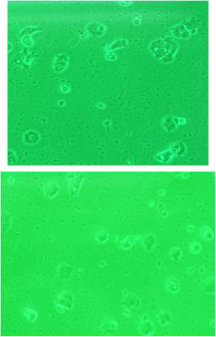 그림 3.115 RGD 처리된 ITO(상), 배양 접시(하)에서 분화된 PC12 세포의 배양 양상