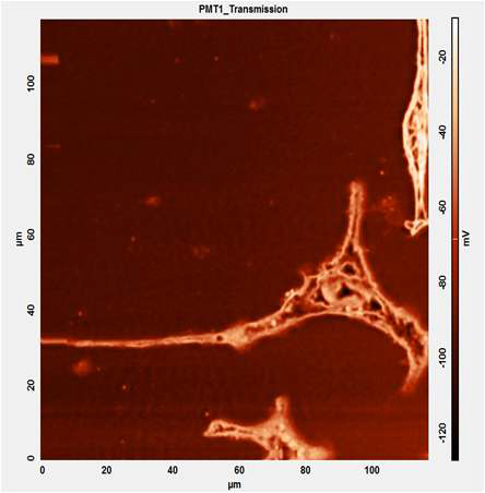 그림 3.118 ITO 기판 위에서 분화된 PC12 세포의 공초점 레이저 현미경 영상