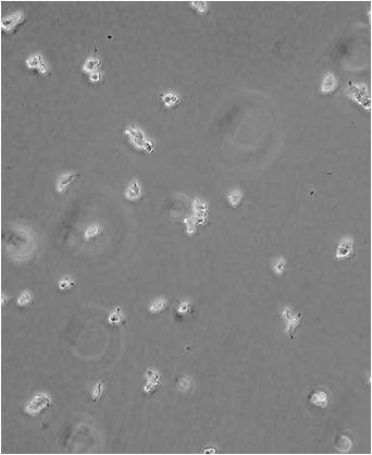 그림 3.1 PC12 세포 사진