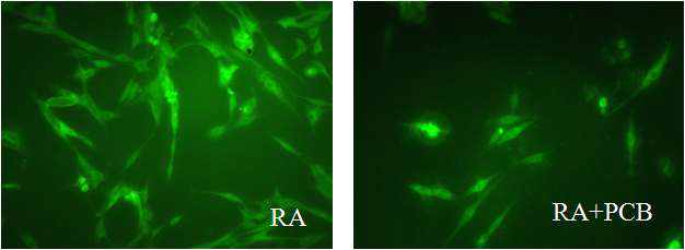그림 3.18 신경 세포의 RA+PCB 처리 전 후 비교