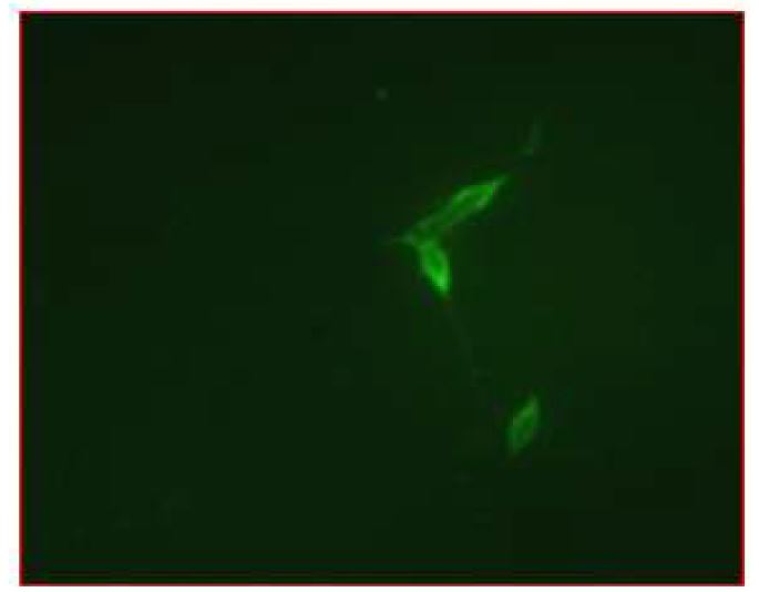 그림 3.21 Retinoic Acid와 PCB를 처리하였을 때 분화 된 신경세포 군