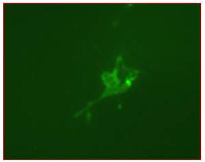 그림 3.22 RA 및 PCB 처리 후 분화 된 신경 세포