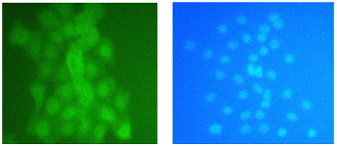 그림 3.27 환경유해물질 Bisphenol A를 처리하기 전 신경세포의 도파민 면역염색(왼쪽)과 DAPI 염색(오른쪽) 모습