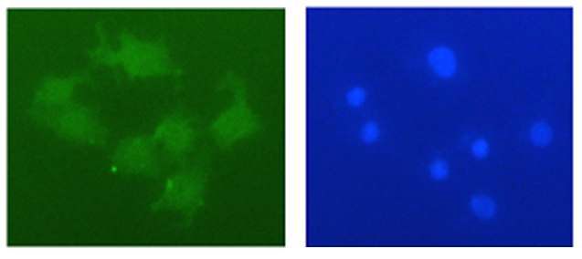 그림 3.28 환경유해물질 Bisphenol A를 처리 후 신경세포의 도파민 면역염색(왼쪽)과 DAPI 염색(오른쪽) 모습