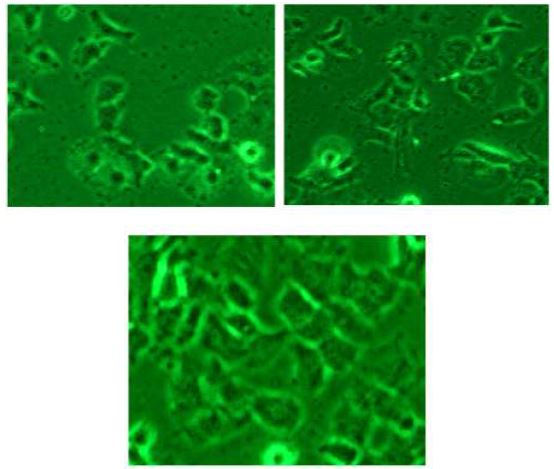 그림 3.42 일반 금기판(상좌), 0.05mg/ml의 기능성 펩타이드가 고정화된 금기판(상우), 0.01mg/ml의 기능성 펩타이드가 고정화된 금기판(하)에서 신경세포의 배양 양상